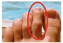 DOBRO POGLEDAJTE PRSTE NA NOGAMA: Ukoliko je drugi prst duži od ostalih, to nije SLUČAJNO!