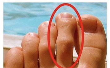 DOBRO POGLEDAJTE PRSTE NA NOGAMA: Ukoliko je drugi prst duži od ostalih, to nije SLUČAJNO!