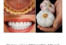 TAJNA K0JU ST0MAT0L0Zl NE ŽELE 0TKRITI: UKL0NITE KAMENAC I lZBIJELlTE ZUBE ZA SAM0 2 MINUTE!