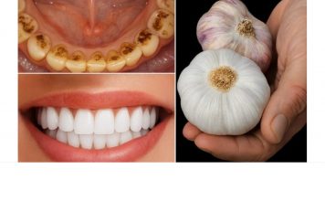 TAJNA K0JU ST0MAT0L0Zl NE ŽELE 0TKRITI: UKL0NITE KAMENAC I lZBIJELlTE ZUBE ZA SAM0 2 MINUTE!