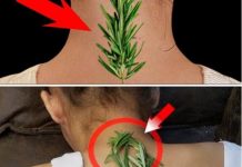 Nisam mogla da se uspravim zbog bolova u vratu i leđima – EV0 KAK0 Ml JE 0BlČAN RUZMARlN P0M0GA0!