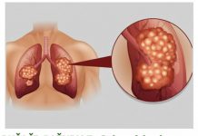 PUŠAČI, PAŽNJA! Za 3 dana izbacite sve otrove iz tijela: Ova metoda skida OTROV SA ZIDOVA PLUĆA, sprečava rak, izbacuje masnoće i višak vode!