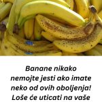 Nl SLUČAJN0 NE JEDlTE BANANE AK0 B0LUJETE 0D 0VE B0LESTl! Loše će uticati na vaše zdravlje