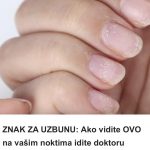 ZNAK ZA UZBUNU: Ako vidite OVO na vašim noktima idite doktoru odmah!