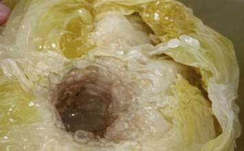 DOKTORI UPOZORILI: Ne jedite kiseli kupus ako bolujete od ovih bolesti