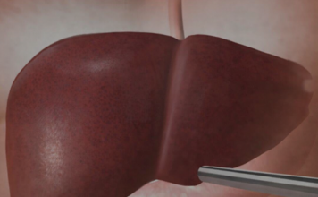 Jetra pod pritiskom: namirnice koje je opterećuju gotovo kao alkohol