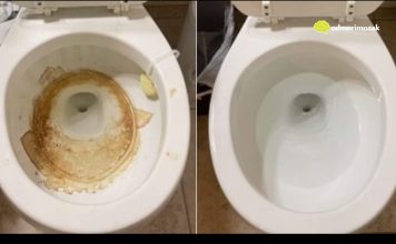 Nije sirće ni soda bikarbona: Ovo sredstvo najbolje uklanja kamenac u WC šolji