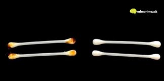 UŠNI VOSAK: šta vam govori o vašem zdravlju i kako pravilno njegovati uši