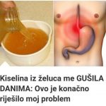 PRlR0DNl NAČlN ZA RJEŠAVANJE KlSELlNE lZ ŽELCA: Efikasne metode za olakšanje …