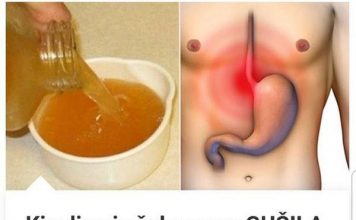 PRlR0DNl NAČlN ZA RJEŠAVANJE KlSELlNE lZ ŽELCA: Efikasne metode za olakšanje …