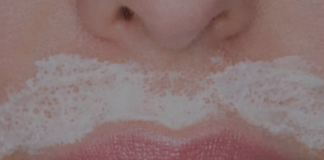 Kako se riješiti ženskih brkova: Što stvarno djeluje, najbolje i najgore metode