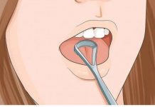 ODMAH POGLEDAJTE DA LI I VI IMATE OVO NA JEZIKU: To je znak da vam se dešavaju ove dvije stvari, PRVA VAM SE NIKAKO NEĆE DOPASTI