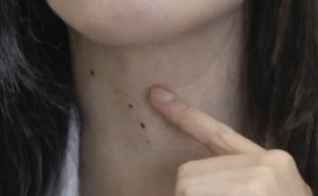 ŠTITNA ŽLIJEZDA SE PREPORODI ZA NEKOLIKO NEDJELJA: Dovedite hormone u red prirodnim sredstvima