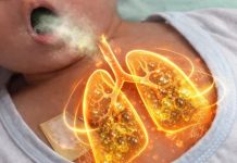 Ovaj kućni lijek rastvara sluz u plućima i oslobađa kašlja. Preko noći uklanja i čisti pluća od sluzi!