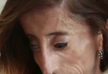 Rekli su joj da je najružnija žena na svijetu i da se ubije – ovo je njen odgovor