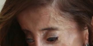 Rekli su joj da je najružnija žena na svijetu i da se ubije – ovo je njen odgovor