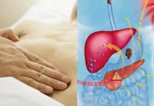 SAČUVAJTE JETRU NA VRIJEME: Evo šta je najviše uništava, a čime je možete obnoviti