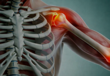 SPAS ZA KOSTI I ZGLOBOVE: Šta žene trebaju jesti nakon pedesete