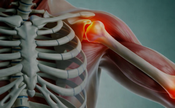 SPAS ZA KOSTI I ZGLOBOVE: Šta žene trebaju jesti nakon pedesete