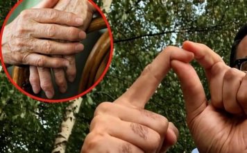 OBLOG KOJI IZVLAČI SAV BOL IZ TIJELA: Provjeren lijek za reumu, išijas, giht i artritis…