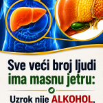 Sve veći broj ljudi ima masnu jetru: Uzrok nije alkohol, već jedan sastojak za koji svi misle da je zdrav