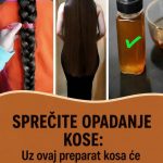 SPREČITE OPADANJE KOSE: Uz ovaj preparat kosa će rasti gušća i jača nego ikada
