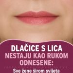 DLAČICE S LICA nestaju kao rukom odnesene: Sve žene širom svijeta potpuno su poludjele za ovim receptom