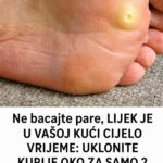 Ne bacajte pare, LIJEK JE U VAŠOJ KUĆI CIJELO VRIJEME: UKLONITE KURIJE OKO ZA SAMO 2 DANA