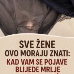 SVE ŽENE OVO MORAJU ZNATI: Kad vam se pojave blijede mrlje na donjem vešu to znači samo jedno