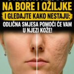 UTRLJAJTE OVO NA BORE I OŽILJKE I GLEDAJTE KAKO NESTAJU: Odlična smjesa pomoći će vam u njezi kože!