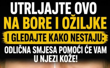 UTRLJAJTE OVO NA BORE I OŽILJKE I GLEDAJTE KAKO NESTAJU: Odlična smjesa pomoći će vam u njezi kože!