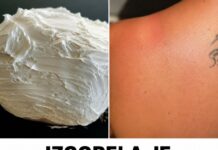 Izgorela je na suncu, a ovo ju je spasilo za 30 minuta: Svi to imamo u kući, a nije jogurt