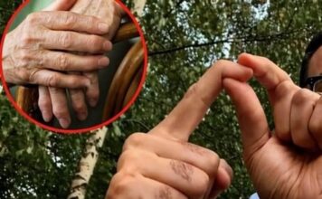 OBLOG KOJI IZVLAČI SAV BOL IZ TIJELA: Prirodno riješenje za reumu, išijas, giht i artritis…