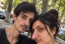 Godinama su se ljudi rugali mom nosu, a nakon operacije moj je muž uklonio sva ogledala iz naše kuće
