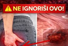R@k debelog crijeva: Znakovi i simptomi koje ne biste trebali zanemariti